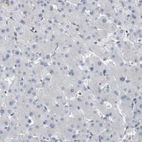 Immunohistochemical staining of human liver shows no positivity in hepatocytes as expected.