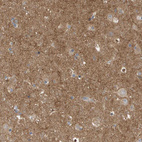 Immunohistochemical staining of human cerebral cortex shows strong positivity in neuropil.