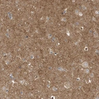 Immunohistochemical staining of human cerebral cortex shows strong positivity in neuropil.