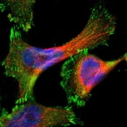 Immunofluorescent staining of human cell line U-251 MG shows localization to plasma membrane & focal adhesion sites.