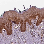Immunohistochemical staining of human skin shows moderate cytoplasmic positivity in squamous epithelial cells.