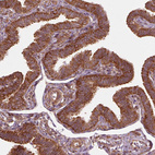 Anti-LSM14A Antibody