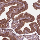 Immunohistochemical staining of human fallopian tube shows moderate cytoplasmic positivity in glandular cells.