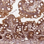 Immunohistochemical staining of human duodenum shows moderate cytoplasmic positivity in glandular cells.