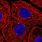 Immunofluorescent staining of human cell line A-431 shows localization to cytoplasmic bodies.