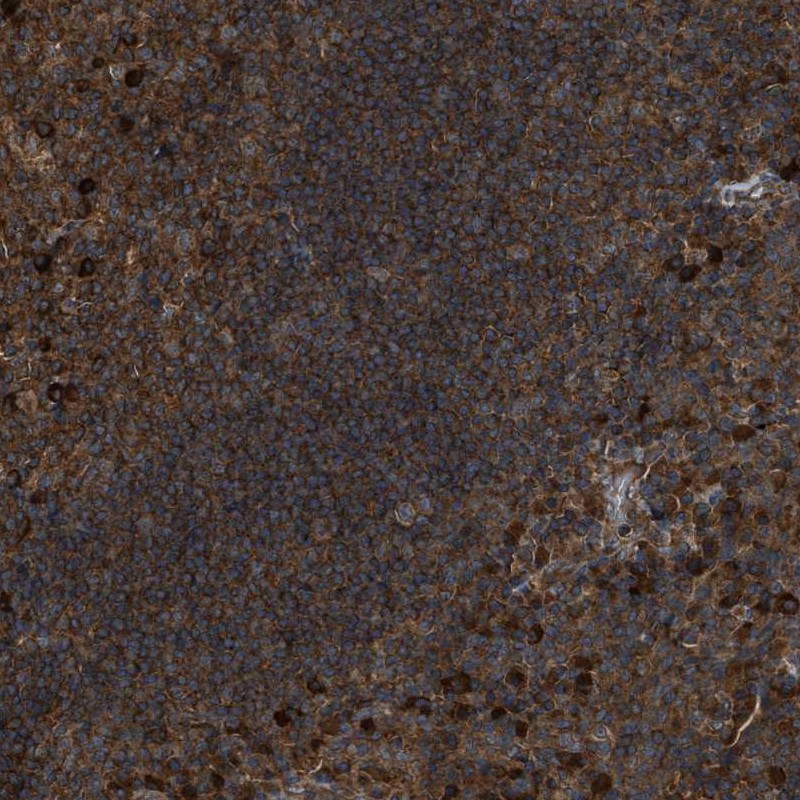 Anti-MAP3K8 Antibody