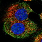 Immunofluorescent staining of human cell line A-431 shows localization to cytosol.