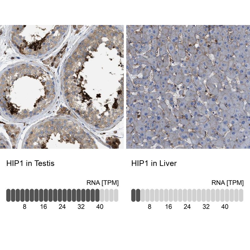 Anti-HIP1 Antibody