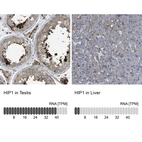 Anti-HIP1 Antibody