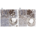 Immunohistochemical staining of human colon, kidney, liver and testis using Anti-HIP1 antibody HPA017964 (A) shows similar protein distribution across tissues to independent antibody HPA013606 (B).