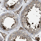 Immunohistochemical staining of human testis shows high expression.