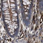 Immunohistochemical staining of human colon using Anti-HIP1 antibody HPA017964.