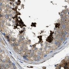 Immunohistochemical staining of human testis using Anti-HIP1 antibody HPA017964.