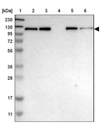Lane 1: Marker [kDa] 230, 130, 95, 72, 56, 36, 28, 17, 11_br/_Lane 2: Human cell line RT-4_br/_Lane 3: Human cell line U-251MG sp_br/_Lane 4: Human plasma (IgG/HSA depleted)_br/_Lane 5: Human liver tissue_br/_Lane 6: Human tonsil tissue