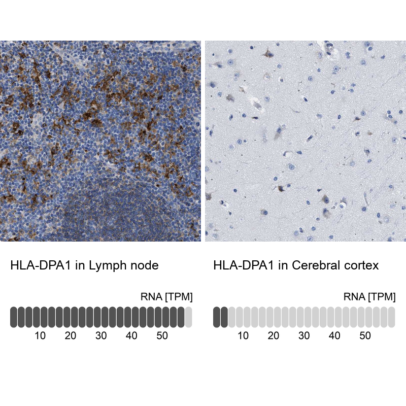 Anti-HLA-DPA1 Antibody