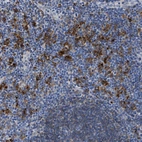 Immunohistochemical staining of human lymph node shows high expression.