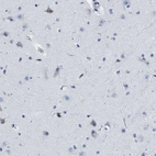 Immunohistochemical staining of human cerebral cortex shows low expression as expected.
