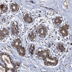 Anti-LRRC3 Antibody