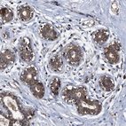 Anti-LRRC3 Antibody