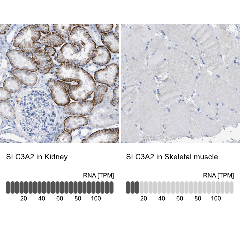 Anti-SLC3A2 Antibody