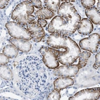 Immunohistochemical staining of human kidney shows strong membranous positivity in cells in tubules.