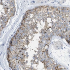 Immunohistochemical staining of human testis shows moderate membranous positivity in cells in seminiferous ducts.