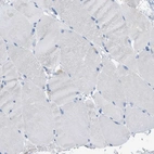 Immunohistochemical staining of human skeletal muscle shows no positivity in myocytes as expected.