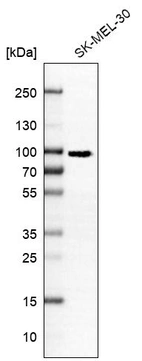 Western blot analysis in human cell line SK-MEL-30.