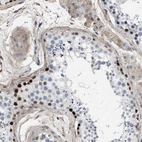 Anti-MAS1L Antibody