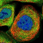 Immunofluorescent staining of human cell line A-431 shows localization to nucleoplasm, plasma membrane & cytosol.