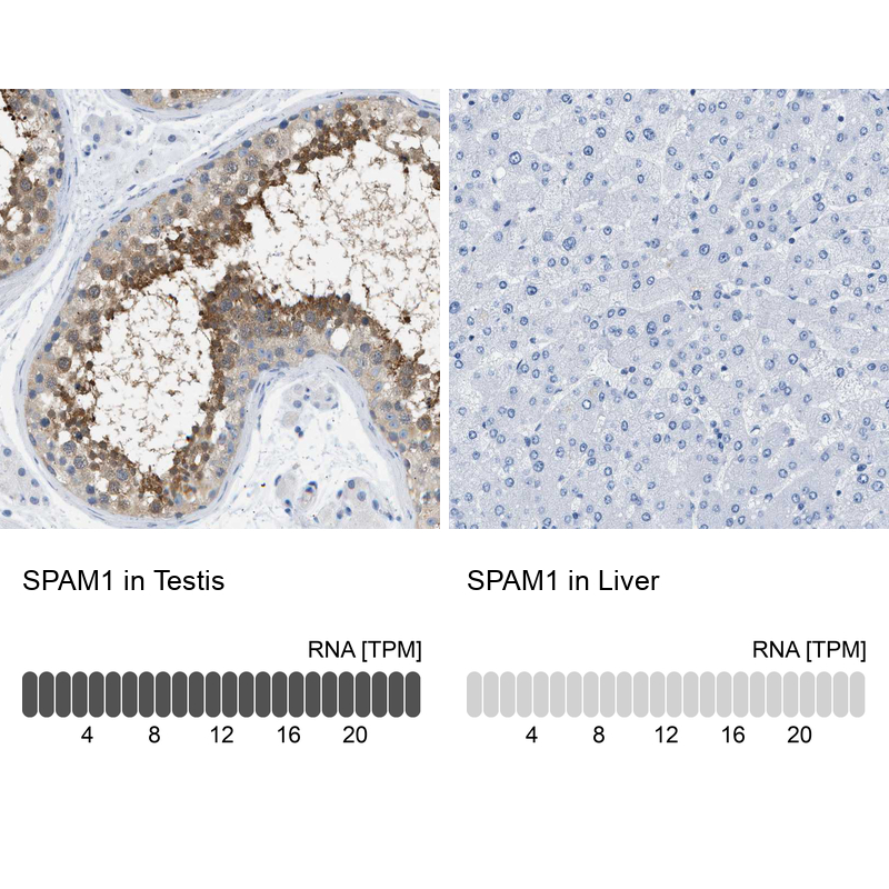 Anti-SPAM1 Antibody