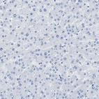 Immunohistochemical staining of human liver shows no positivity in hepatocytes as expected.