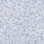 Immunohistochemical staining of human liver shows no positivity in hepatocytes as expected.