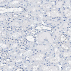 Immunohistochemical staining of human kidney shows no positivity in cells in tubules as expected.