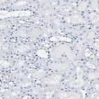 Immunohistochemical staining of human kidney shows no positivity in cells in tubules as expected.