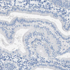 Immunohistochemical staining of human endometrium shows no positivity in glandular cells as expected.
