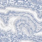 Immunohistochemical staining of human endometrium shows no positivity in glandular cells as expected.