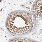 Anti-MFAP3L Antibody