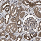 Immunohistochemical staining of human kidney shows moderate to strong cytoplasmic positivity in cells in tubules.