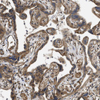 Immunohistochemical staining of human placenta shows moderate cytoplasmic and membranous positivity in trophoblastic cells.