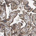 Immunohistochemical staining of human placenta shows moderate cytoplasmic and membranous positivity in trophoblastic cells.