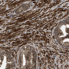 Immunohistochemical staining of human prostate shows strong cytoplasmic positivity in smooth muscle cells.