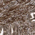 Immunohistochemical staining of human prostate shows strong cytoplasmic positivity in smooth muscle cells.