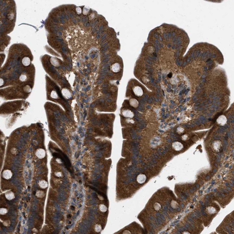 Anti-KIAA0430 Antibody