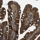 Anti-KIAA0430 Antibody