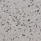 Immunohistochemical staining of human cerebral cortex shows strong granular cytoplasmic positivity in neurons.