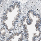 Immunohistochemical staining of human prostate shows shows moderate granular cytoplasmic positivity in glandular cells.