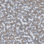 Immunohistochemical staining of human liver shows shows strong granular cytoplasmic positivity in hepatocytes.