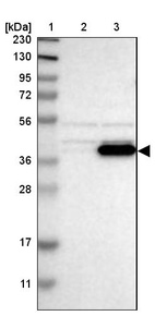 Lane 1: Marker [kDa] 230, 130, 95, 72, 56, 36, 28, 17, 11_br/_Lane 2: Human cell line RT-4_br/_Lane 3: Human cell line U-251MG sp