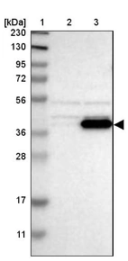 Lane 1: Marker [kDa] 230, 130, 95, 72, 56, 36, 28, 17, 11_br/_Lane 2: Human cell line RT-4_br/_Lane 3: Human cell line U-251MG sp